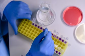 Magnetic Beads Protein Purification