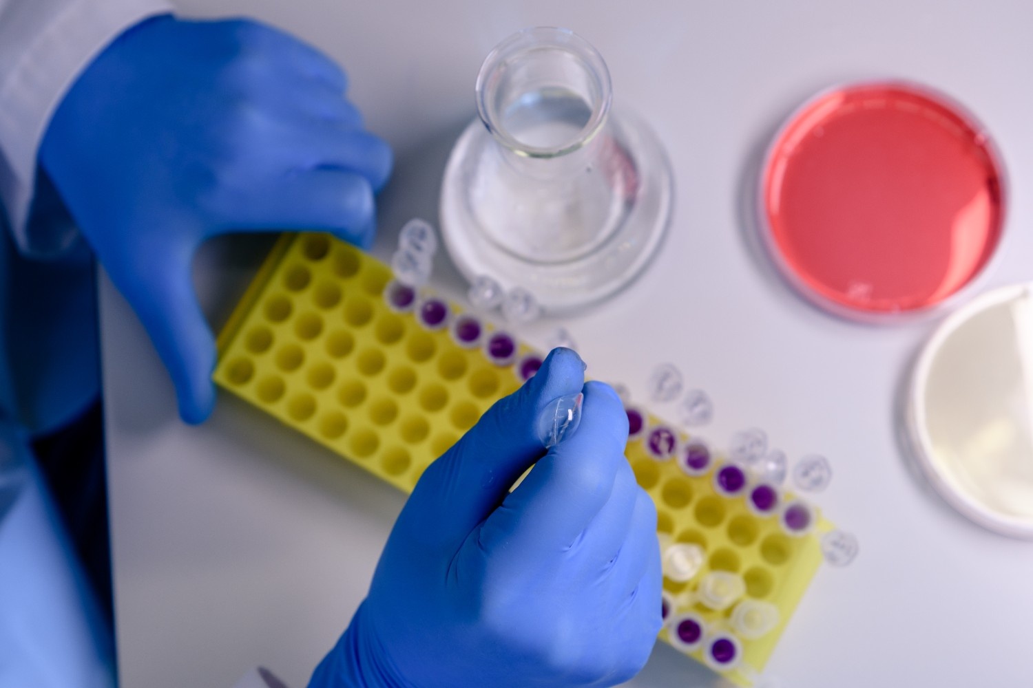 Magnetic Beads Protein Purification